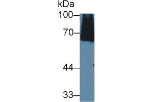 Detection of C8a in Mouse Serum using Polyclonal Antibody to Complement Component 8a (C8a) (C8A 抗体  (AA 21-300))
