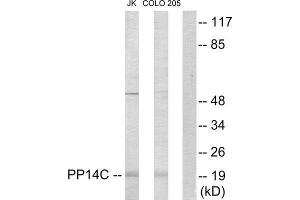 Western Blotting (WB) image for anti-Protein Phosphatase 1, Regulatory (Inhibitor) Subunit 14C (PPP1R14C) (Internal Region) antibody (ABIN1849804) (PPP1R14C 抗体  (Internal Region))
