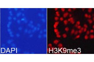 Immunofluorescence (IF) image for anti-Histone 3 (H3) (H3K9me3) antibody (ABIN3016030)