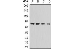 Western blot analysis of PRC1 expression in MCF7 (A), Jurkat (B), Hela (C), HepG2 (D) whole cell lysates. (PRC1 抗体)
