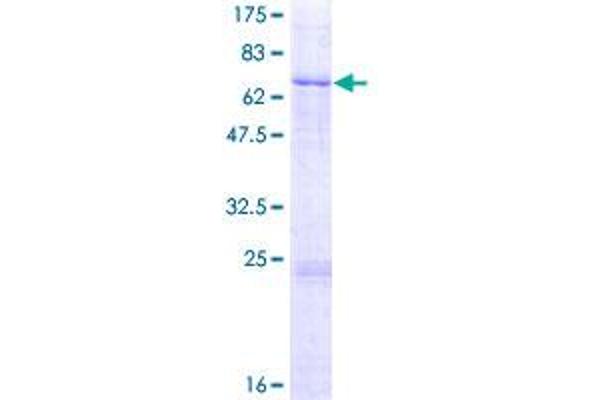 L2HGDH Protein (AA 1-441) (GST tag)