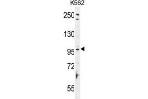 Western Blotting (WB) image for anti-Taste Receptor, Type 1, Member 2 (TAS1R2) antibody (ABIN2996356) (TAS1R2 抗体)