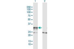 Western Blot analysis of ADAMTS4 expression in transfected 293T cell line by ADAMTS4 MaxPab polyclonal antibody. (ADAMTS4 抗体  (AA 1-339))