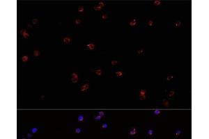Immunofluorescence analysis of Jurkat cells using PTPRC Polyclonal Antibody at dilution of 1:100. (CD45 抗体)