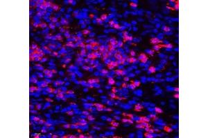 Immunofluorescence of paraffin embedded human colon cancer using Aldh4a1 (ABIN7073000) at dilution of 1: 400 (400x lens) (ALDH4A1 抗体)