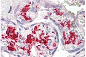 Human Placenta (formalin-fixed, paraffin-embedded) stained with AIF1 antibody ABIN337129 at 2. (Iba1 抗体  (AA 42-56))