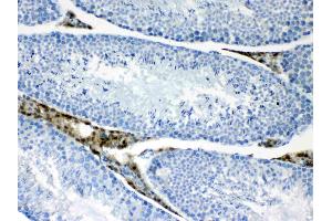 Immunohistochemistry (IHC) image for anti-Protein Phosphatase 1, Regulatory (Inhibitor) Subunit 14A (PPP1R14A) (AA 30-126) antibody (ABIN5518865)