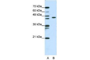 ZBTB9 antibody used at 0. (ZBTB9 抗体  (N-Term))
