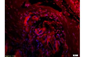 Immunofluorescence (IF) image for anti-Collagen Triple Helix Repeat Containing 1 (CTHRC1) (AA 31-130) antibody (ABIN759281)