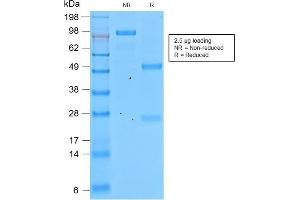 SDS-PAGE Analysis of Purified Involucrin Rabbit Recombinant Monoclonal Antibody (IVRN/2113R). (Recombinant Involucrin 抗体)
