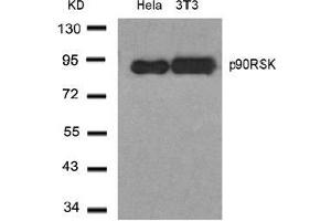 Image no. 1 for anti-Ribosomal Protein S6 Kinase, 90kDa, Polypeptide 1 (RPS6KA1) (Thr348) antibody (ABIN197329) (RPS6KA1 抗体  (Thr348))