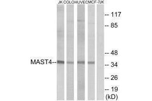 Western blot analysis of extracts from Jurkat cells, COLO cells, HUVEC cells and MCF-7 cells, using MAST4 antibody. (MAST4 抗体)