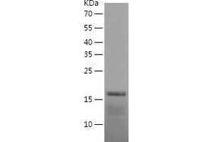 BTG2 Protein (AA 1-158) (His tag)