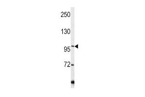 Western blot analysis of COL6A1 antibody in Y79 cell line lysates (35ug/lane) (COL6A1 抗体  (C-Term))