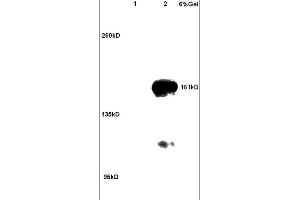 Lane 1: rat brain lysates Lane 2: human colon carcinoma lysates probed with Anti ROCK2 Polyclonal Antibody, Unconjugated (ABIN673359) at 1:200 in 4C. (ROCK2 抗体  (AA 1001-1300))