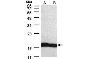 WB Image Sample(30 μg of whole cell lysate) A:H1299 B:HeLa S3, 12% SDS PAGE antibody diluted at 1:5000 (PPIA 抗体  (C-Term))