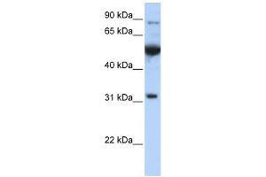 EIF2B1 antibody used at 1 ug/ml to detect target protein. (EIF2B1 抗体  (C-Term))