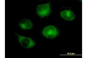 Immunofluorescence of purified MaxPab antibody to RABGAP1 on HeLa cell. (RABGAP1 抗体  (AA 1-997))