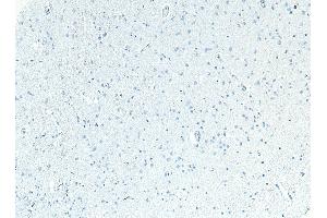Immunohistochemistry (IHC) image for anti-Sodium Channel, Voltage-Gated, Type V, alpha Subunit (SCN5A) (Internal Region) antibody (ABIN185467)