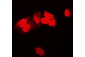 Immunofluorescent analysis of Focal Adhesion Kinase staining in HeLa cells. (FAK 抗体  (Center))