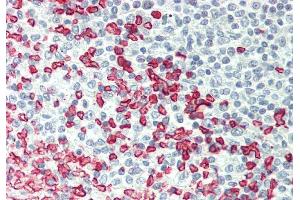 Rabbit Anti-ERMAP antibody  Formalin Fixed Paraffin Embedded Tissue: Human Spleen Primary antibody Concentration: 1:100 Secondary Antibody: Donkey anti-Rabbit-Cy3 Secondary Antibody Concentration: 1:200 Magnification: 20x Exposure Time: 0. (ERMAP 抗体  (Middle Region))