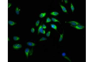 Immunofluorescent analysis of Hela cells using ABIN7146564 at dilution of 1:100 and Alexa Fluor 488-congugated AffiniPure Goat Anti-Rabbit IgG(H+L) (Calreticulin 抗体  (AA 18-415))