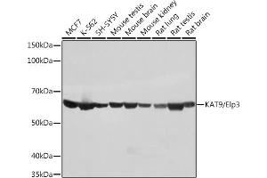 Western blot analysis of extracts of various cell lines, using K/Elp3 Rabbit mAb (ABIN1680361, ABIN3015008, ABIN3015009 and ABIN7101302) at 1:1000 dilution. (ELP3/KAT9 抗体)
