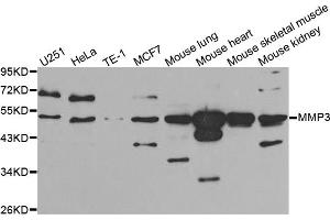Western blot analysis of extracts of various cell lines, using MMP3 antibody (ABIN5970544) at 1/1000 dilution. (MMP3 抗体)