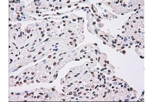 Image no. 1 for anti-Polo-Like Kinase 1 (PLK1) antibody (ABIN1500283) (PLK1 抗体)