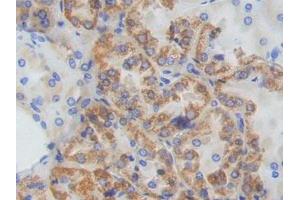 IHC-P analysis of Human Kidney Tissue, with DAB staining. (ADCY9 抗体  (AA 1029-1282))