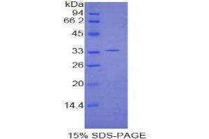 SDS-PAGE analysis of Human Karyopherin alpha 1 Protein. (KPNA1 蛋白)