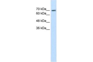 Western Blotting (WB) image for anti-EPS8-Like 1 (EPS8L1) antibody (ABIN2462593) (EPS8-Like 1 抗体)