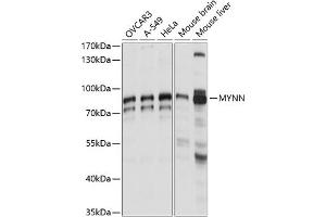 Western blot analysis of extracts of various cell lines, using MYNN antibody (ABIN7268741) at 1:1000 dilution. (Myoneurin 抗体  (AA 1-300))