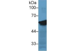Western Blotting (WB) image for anti-Vimentin (VIM) antibody (ABIN7426163)