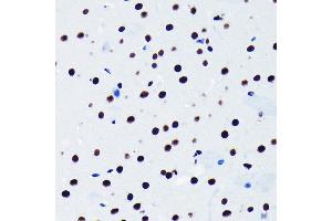 Immunohistochemistry of paraffin-embedded mouse brain using TDP-43/TARDB Rabbit mAb (ABIN7270730) at dilution of 1:100 (40x lens). (TARDBP 抗体)