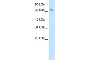 Western Blotting (WB) image for anti-Kelch-like protein 41 (KLHL41) antibody (ABIN2461775) (Kelch-like protein 41 (KLHL41) 抗体)