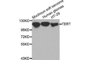 Western blot analysis of extracts of various cell lines, using TERT antibody. (TERT 抗体  (C-Term))