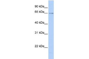 WB Suggested Anti-PPIL2 Antibody Titration: 0. (PPIL2 抗体  (C-Term))