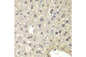 Immunohistochemistry of paraffin-embedded mouse liver using NR3C1 antibody. (Glucocorticoid Receptor 抗体)