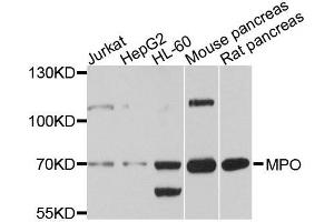 Western blot analysis of extracts of various cells, using MPO antibody. (Myeloperoxidase 抗体)