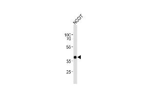 Anti-DA4 Antibody (Center) at 1:1000 dilution + NCCIT whole cell lysates Lysates/proteins at 20 μg per lane. (DPPA4 抗体  (AA 107-142))