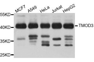 Western Blotting (WB) image for anti-Tropomodulin 3 (TMOD3) (AA 1-352) antibody (ABIN1683055) (TMOD3 抗体  (AA 1-352))