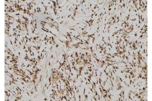 ABIN6279761 at 1/100 staining Human gastric tissue by IHC-P. (RFPL2 抗体)