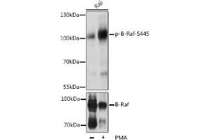 Western blot analysis of extracts of Raji cells, using Phospho-B-Raf-S445 pAb (ABIN3019431, ABIN3019432, ABIN3019433, ABIN1681422 and ABIN6225367) at 1:2000 dilution or BRAF antibody (ABIN6131244, ABIN6137637, ABIN6137639 and ABIN6213593). (BRAF 抗体  (pSer445))