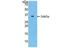 Detection of Recombinant MMP7, Mouse using Polyclonal Antibody to Matrix Metalloproteinase 7 (MMP7) (MMP7 抗体  (AA 1-264))