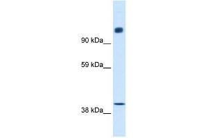 NCOR1 antibody used at 0. (NCOR1 抗体  (N-Term))