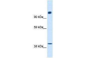 NCOR1 antibody used at 0.
