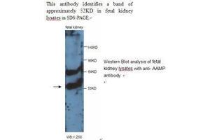 Image no. 1 for anti-Angio-Associated, Migratory Cell Protein (AAMP) antibody (ABIN790850) (AAMP 抗体)