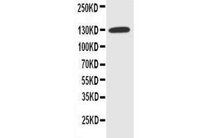 Western Blotting (WB) image for anti-Solute Carrier Family 12 (Potassium-Chloride Transporter) Member 2 (SLC12A2) (AA 223-241), (N-Term) antibody (ABIN3043994)