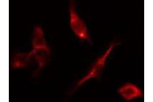 ABIN6278199 staining HepG2 by IF/ICC. (DAPK2 抗体  (C-Term))